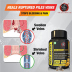YogaManLab® Piles Matrix - वेन रिस्टोर + रेक्टम रिस्टोर+ डाइट बुकलेट