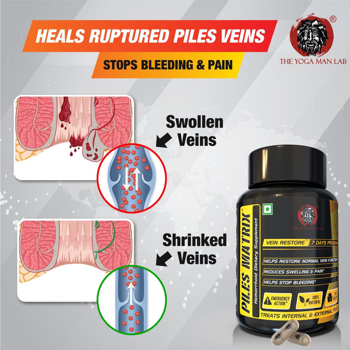 YogaManLab® Piles Matrix - वेन रिस्टोर + रेक्टम रिस्टोर+ डाइट बुकलेट