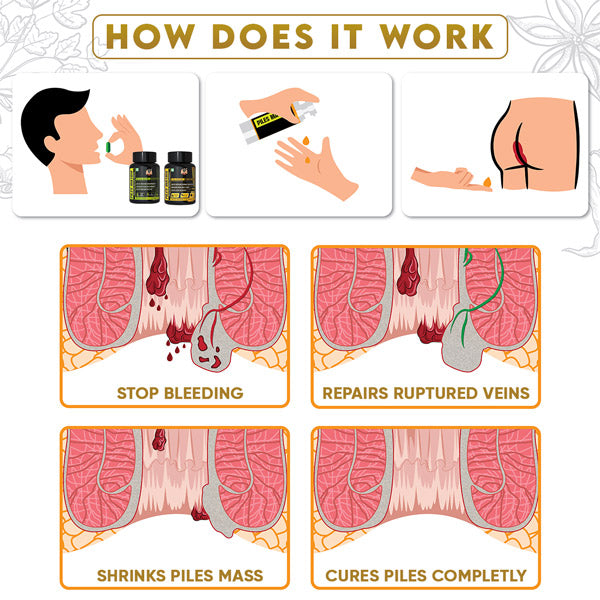 PILES MATRIX - Piles Treatment Ayurvedic Capsules & Lepam Ointment | With Free Diet & Doctor | Treats Internal Grade1-4 & External Hemorrhoids | 100% Natural