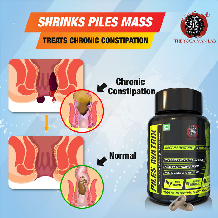 YogaManLab® Piles Matrix - वेन रिस्टोर + रेक्टम रिस्टोर+ डाइट बुकलेट