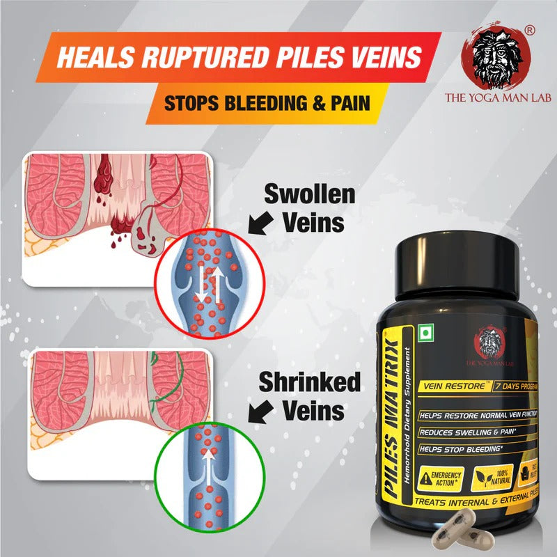 YogaManLab® PILES MATRIX Vein Restore Ayurvedic Medicine | Stops Bleeding, Relieves Pain & Itching | 100% Natural