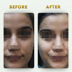 YogaManLab® Multani Mitti Glow Face Pack – For Deep Pore Cleansing, Acne Defense & Tan Removal (With Chandan, Turmeric & Orange Peel)
