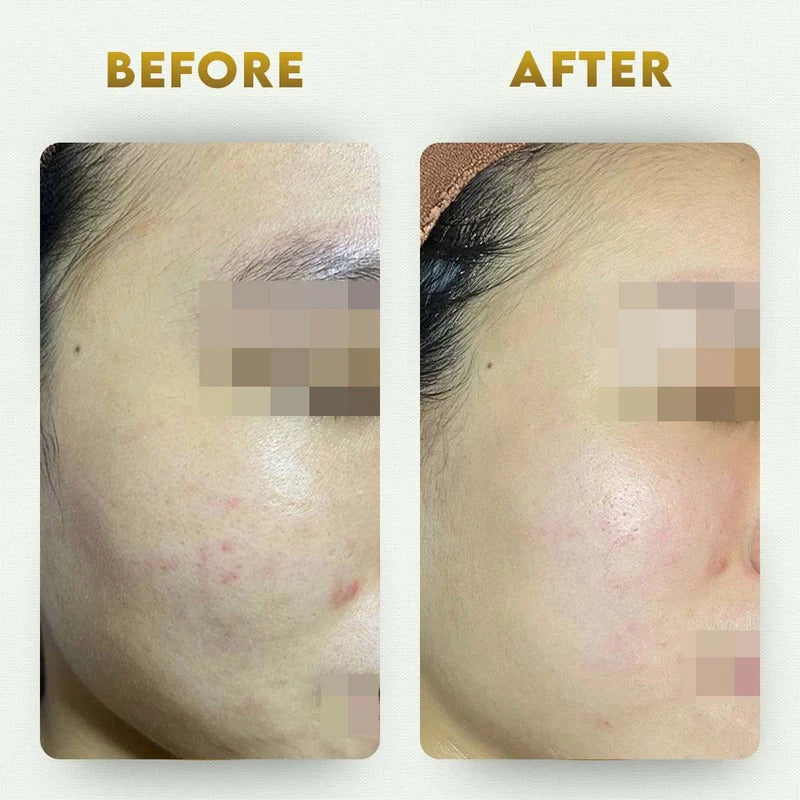 YogaManLab® Multani Mitti Glow Face Pack – For Deep Pore Cleansing, Acne Defense & Tan Removal (With Chandan, Turmeric & Orange Peel)