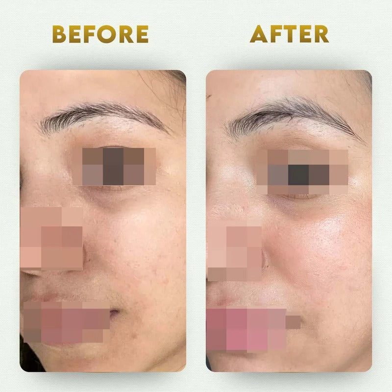 YogaManLab® Multani Mitti Glow Face Pack – For Deep Pore Cleansing, Acne Defense & Tan Removal (With Chandan, Turmeric & Orange Peel)