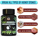 YogaManLab® STONE DISSOLVER+ - Stone Remover Ayurvedic Supplement | 100% Natural & Plant Based