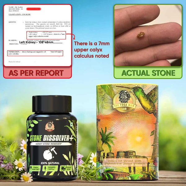 YogaManLab® STONE DISSOLVER+ - Stone Remover Ayurvedic Supplement | 100% Natural & Plant Based